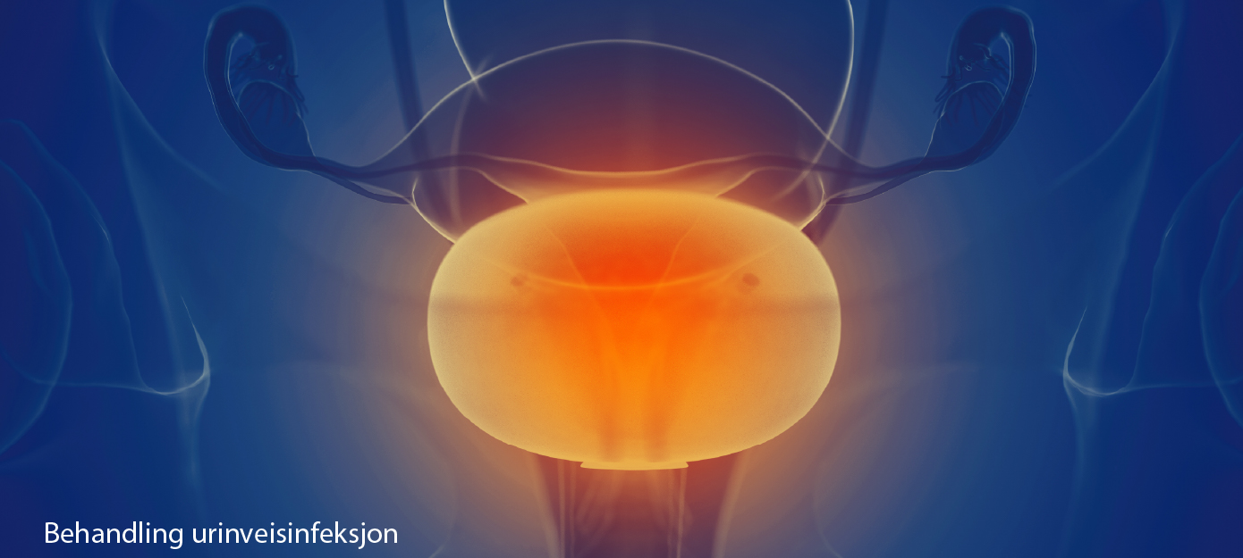 Urinveisinfeksjon