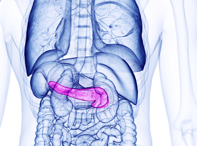 EPI og akutt pankreatitt